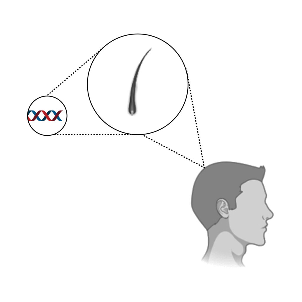  Genetic connection with hair loss
