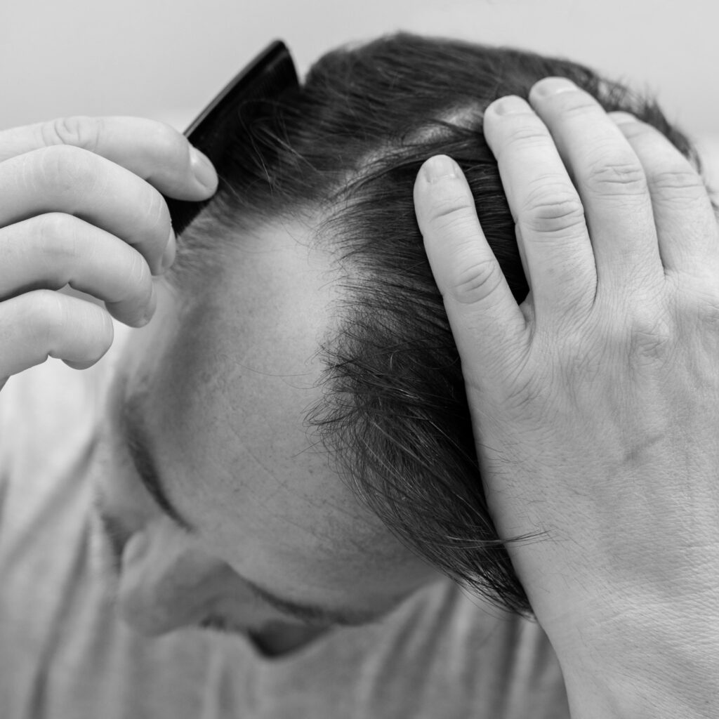 Hair loss and hair thinning