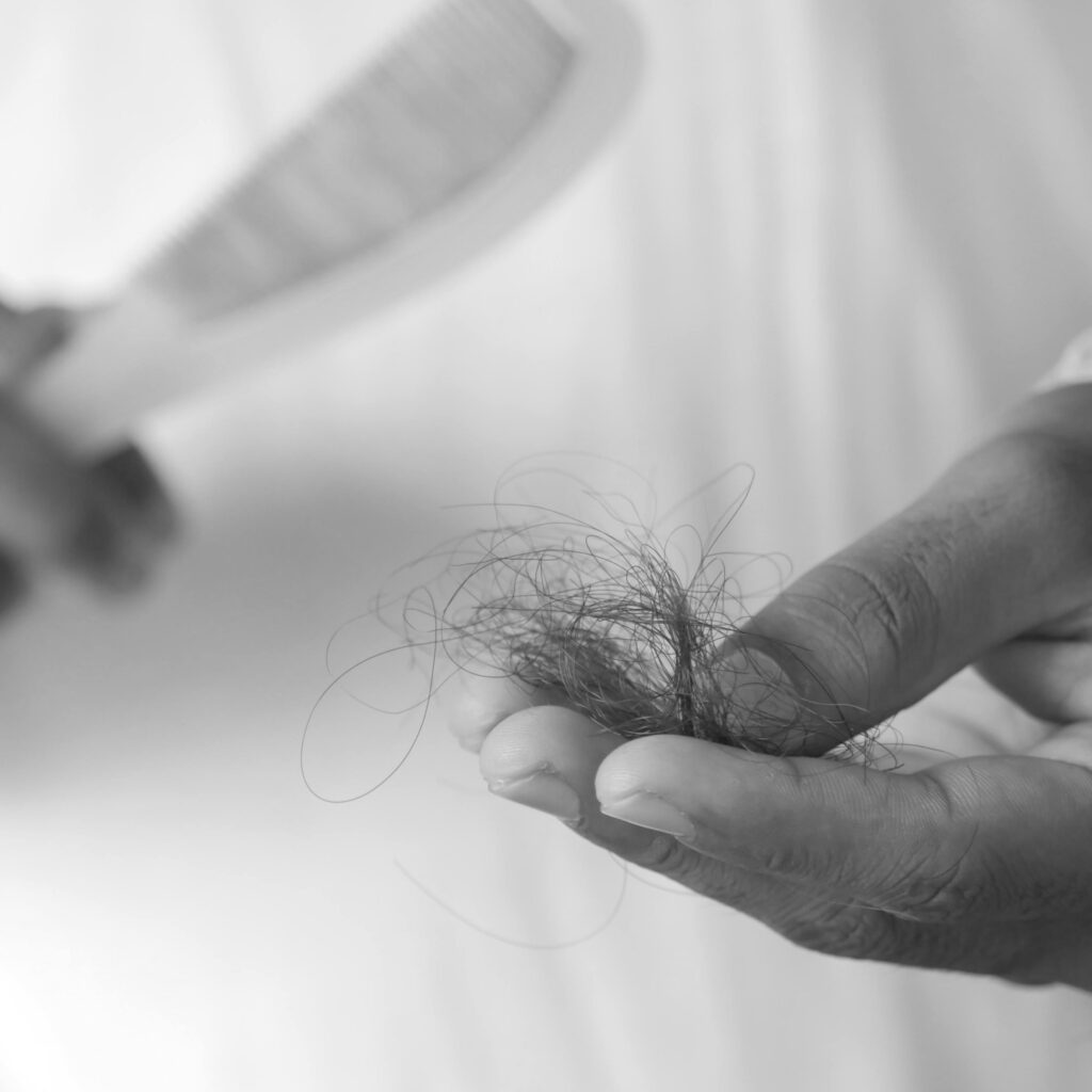 Hair thinning and hair loss
