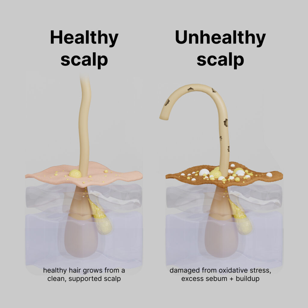 Unhealthy scalp
